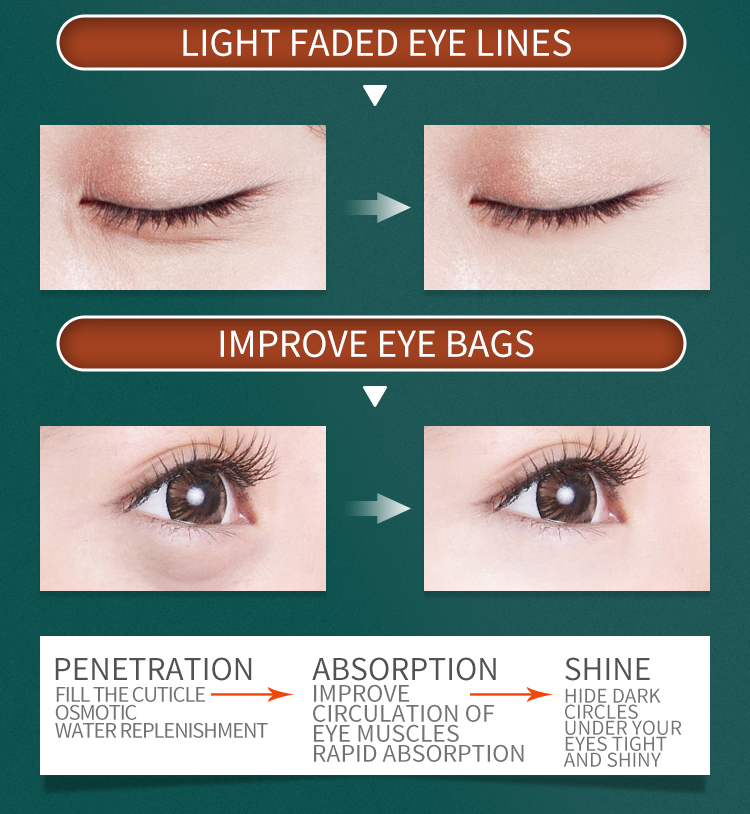 imbunatateste crema de ochi pentru cearcane (2)