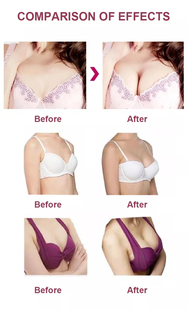 Breast Enhancement Cream (7)