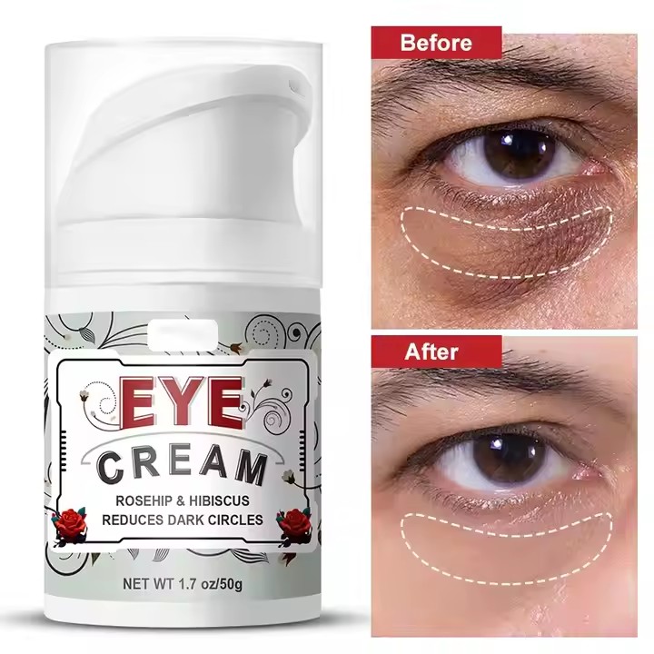 Eye Cream supplier