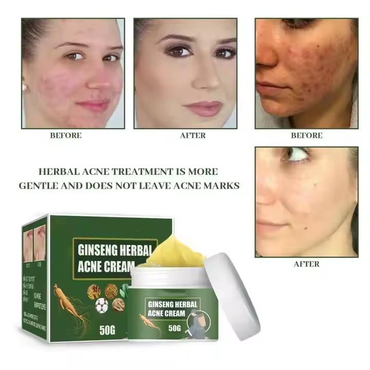Face Cream supplier