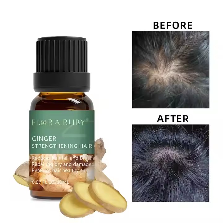 best Essential Oil