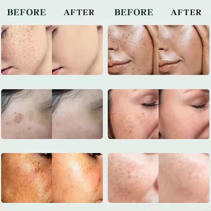 custom Face Cream
