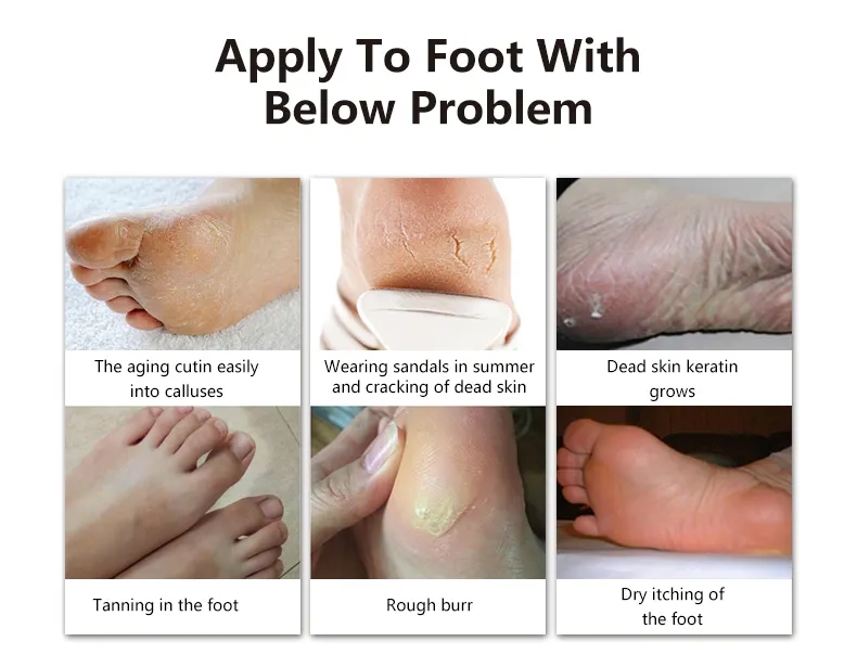 exfoliating foot mask