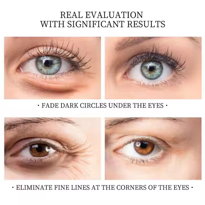 famous Eye Gel Mask