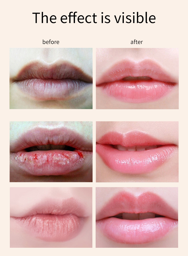 sleep lip mask